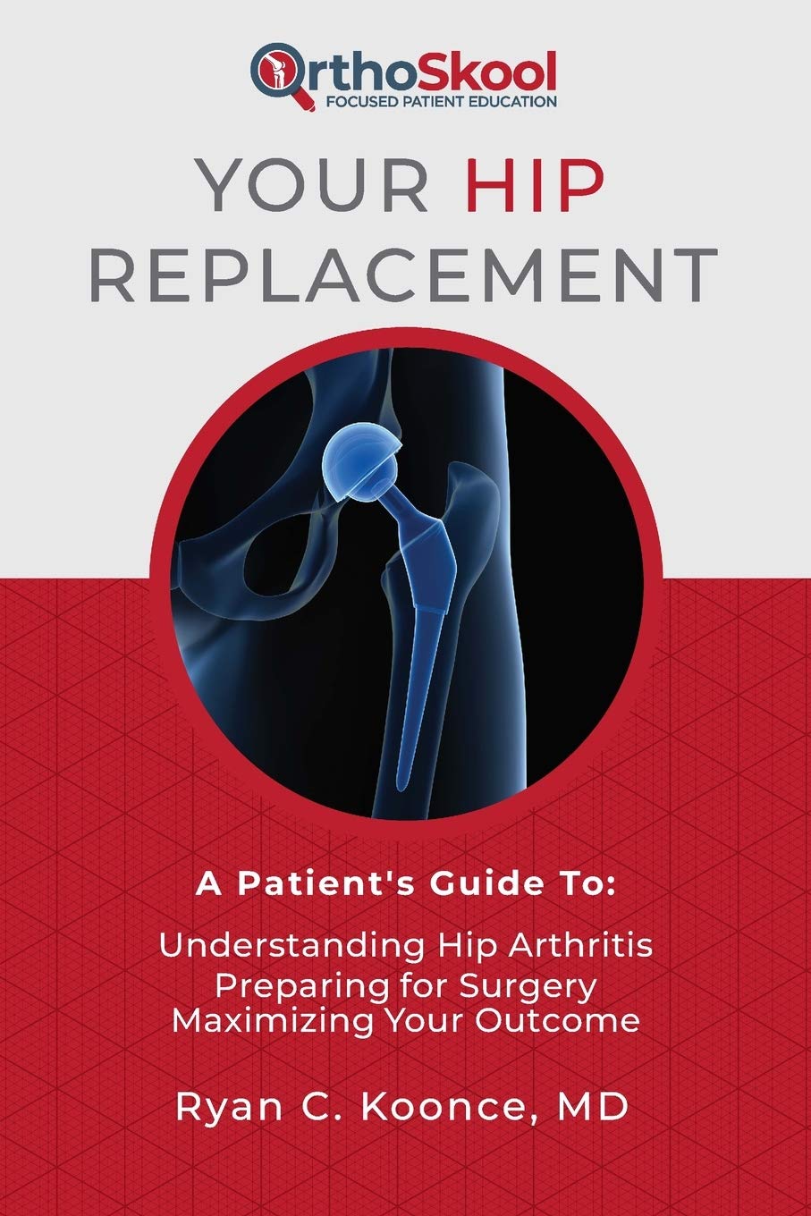 Your Hip Replacement: A Patient's Guide To: Understanding Hip Arthritis, Preparing for Surgery, Maximizing Your Outcome - 1182