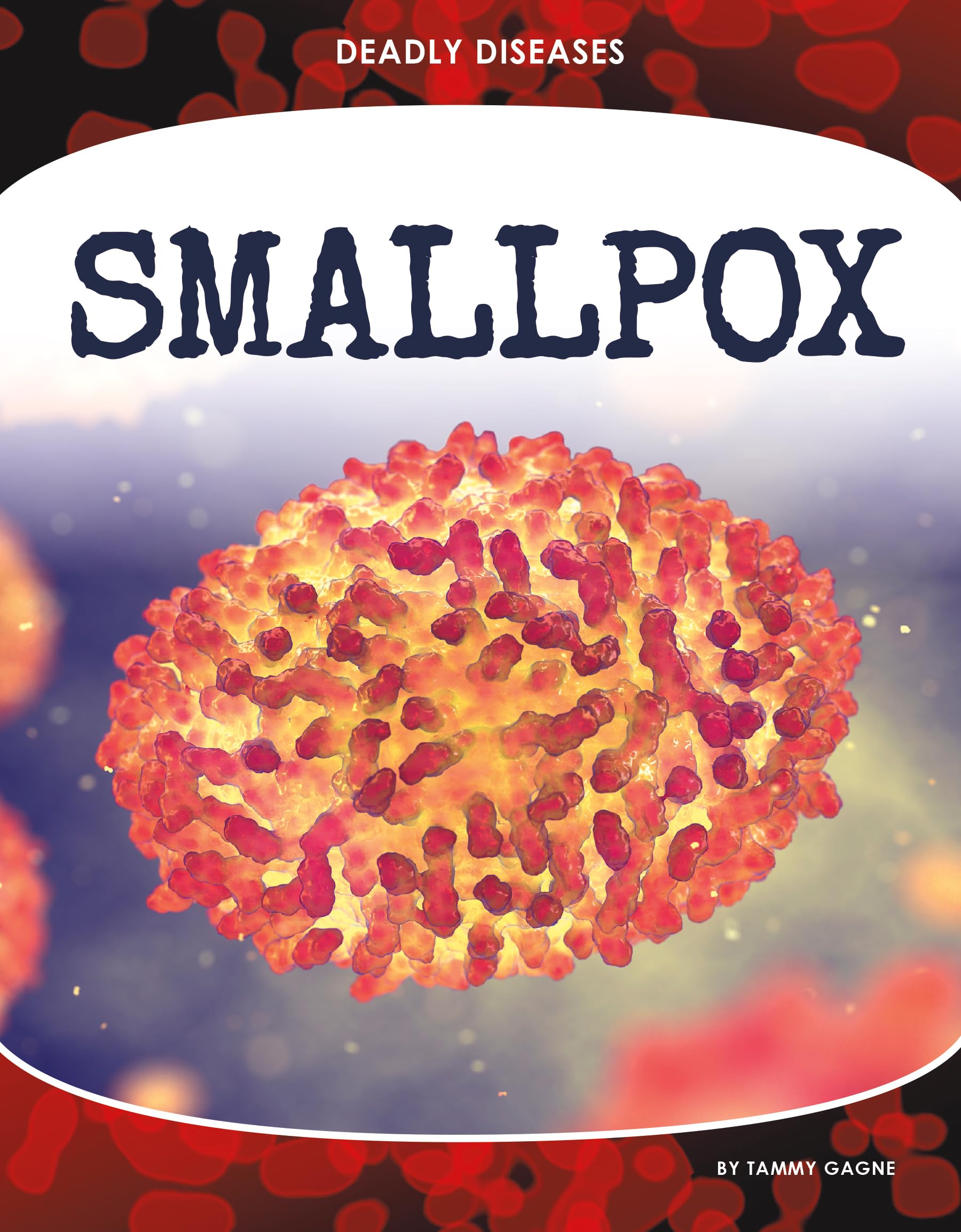 Smallpox (Deadly Diseases) - 5837