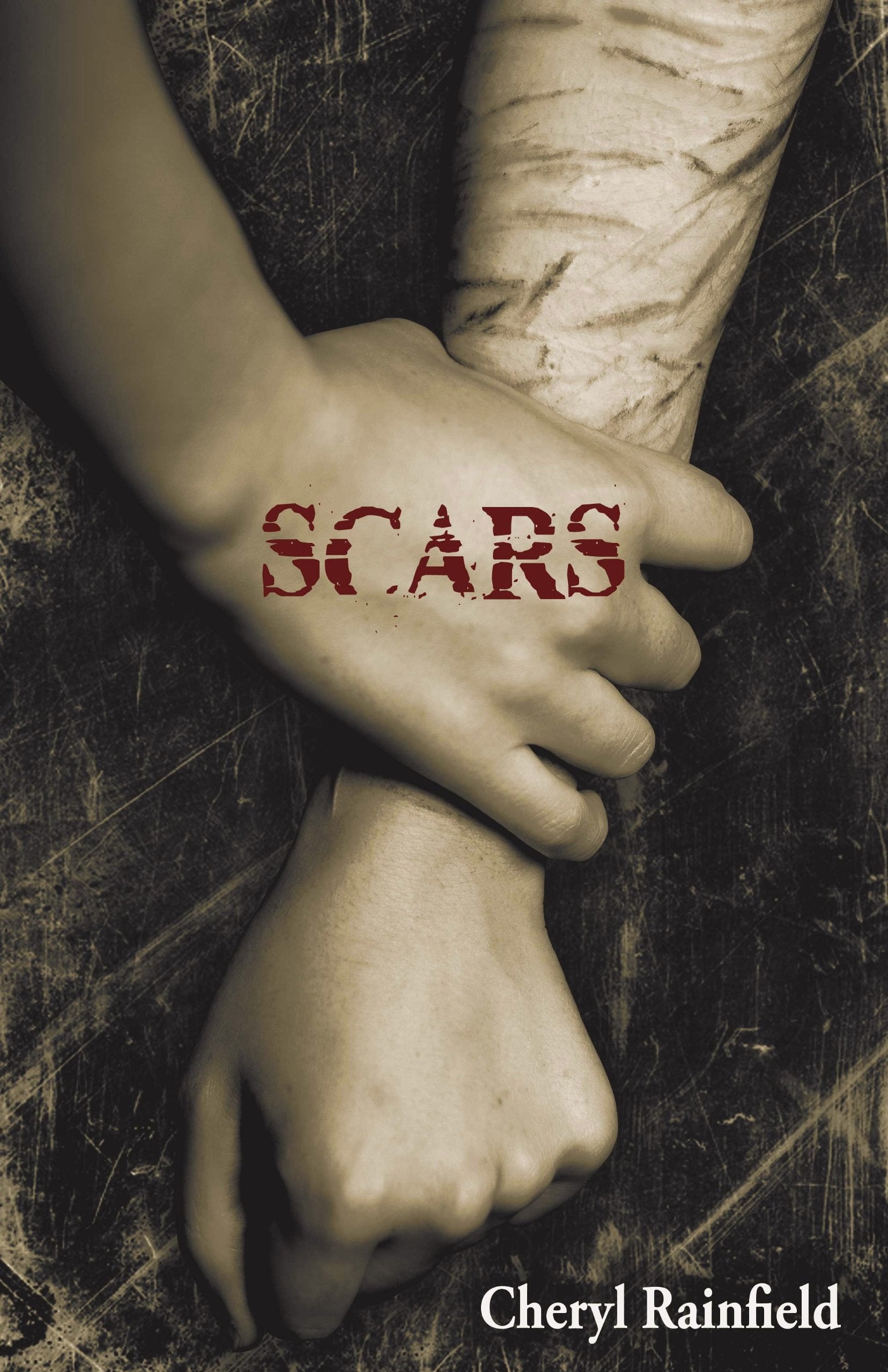 Scars - 1399