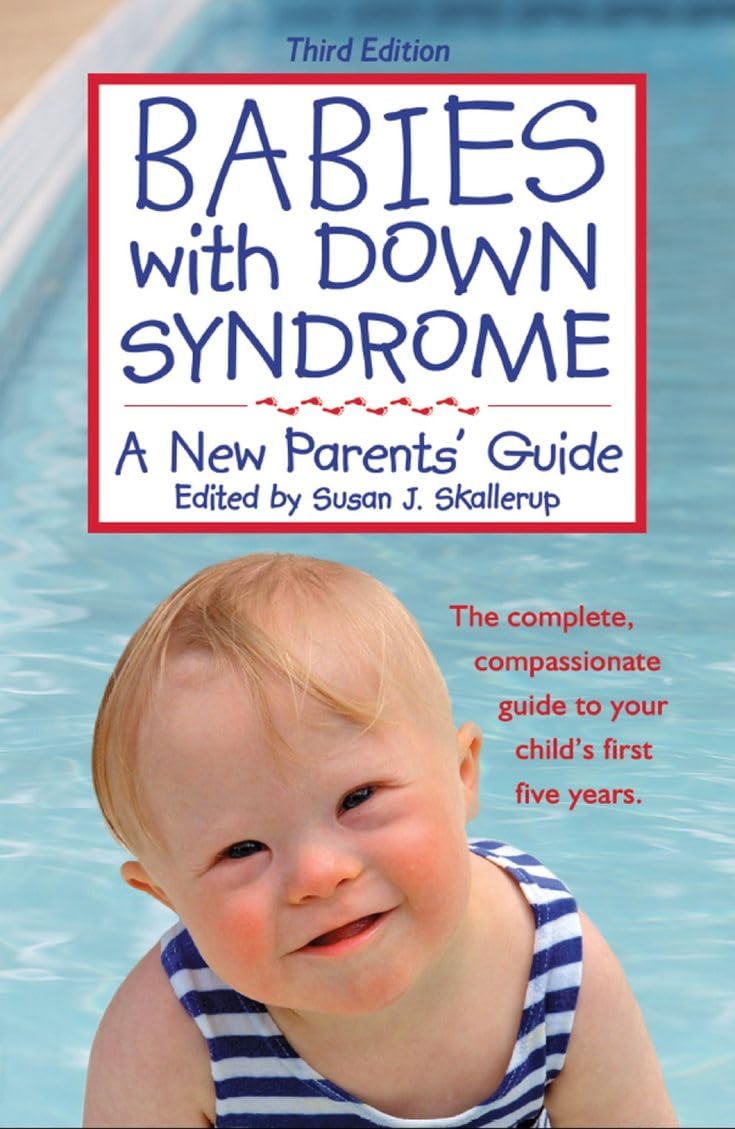 Babies With Down Syndrome: A New Parents' Guide - 5752