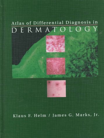 Atlas of Differential Diagnosis in Dermatology - 4454