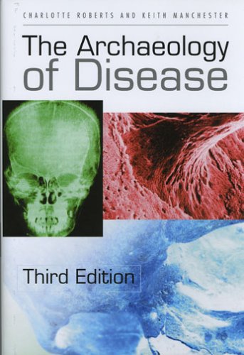 The Archaeology of Disease - 3444